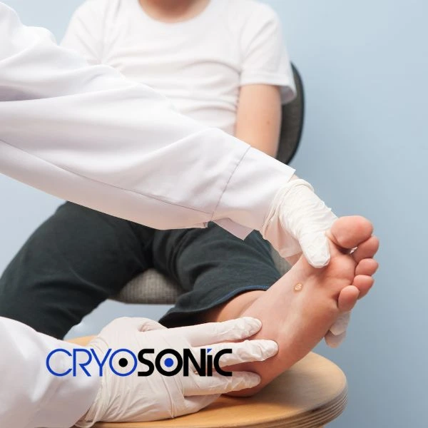 Are you looking for fast effective wart removal Contact us today Aylesbury